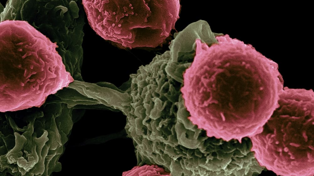 GigaTIME AI tool advances cancer research post image