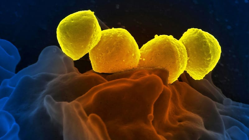 Multiply Labs uses robotics and NVIDIA simulation to scale cell therapy manufacturing post image